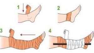 Cách sơ cứu ban đầu khi bị rắn độc cắn đúng cách